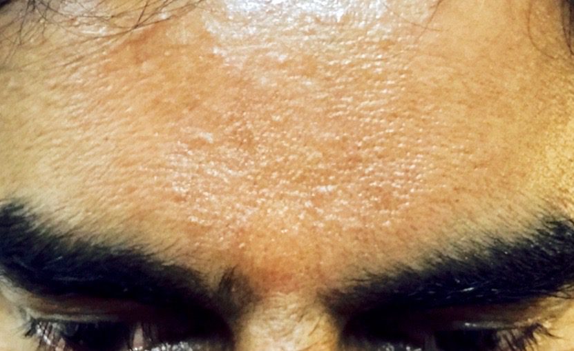 Aum sign appeared on Mohanji's forehead during the satsang